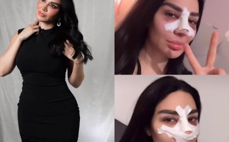 بعد أزمة تنفس وجراحة دقيقة.. سارة نخلة تكشف كواليس معاناتها الصحية وتفاصيل التعافي