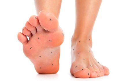 أسباب تنميل القدم.. الأعراض وطرق العلاج والوقاية
