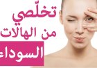 طرق طبيعية فعالة لـ علاج الهالات السوداء واستعادة نضارة البشرة