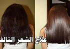 علاج الشعر التالف 2026.. أحدث التقنيات لاستعادة قوة ولمعان الشعر