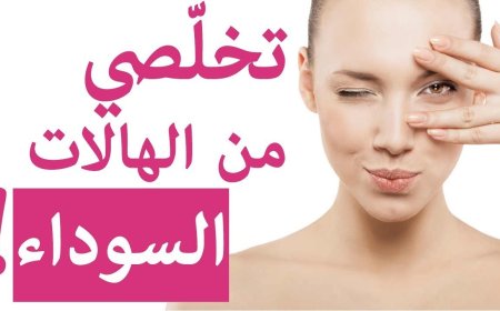 طرق طبيعية فعالة لـ علاج الهالات السوداء واستعادة نضارة البشرة