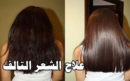 علاج الشعر التالف 2026.. أحدث التقنيات لاستعادة قوة ولمعان الشعر