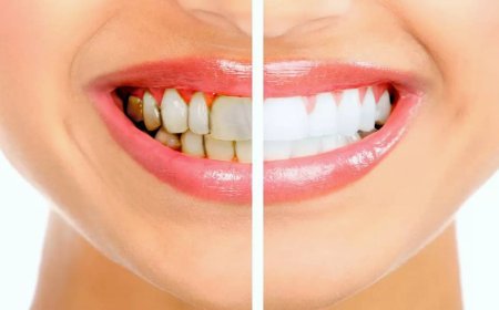 كيفية التخلص من اصفرار الأسنان بطرق طبيعية فعالة لاستعادة بياض الابتسامة