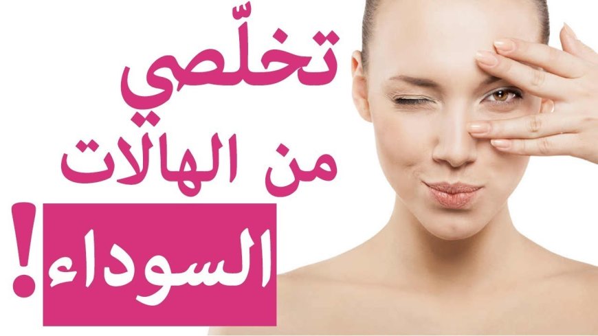 طرق طبيعية فعالة لـ علاج الهالات السوداء واستعادة نضارة البشرة