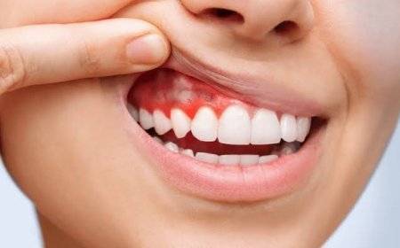 أمراض اللثة.. كيف تؤثر بكتيريا الفم على استقرار قلبك؟